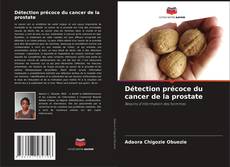 Capa do livro de Détection précoce du cancer de la prostate 