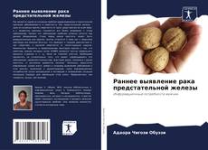 Bookcover of Раннее выявление рака предстательной железы