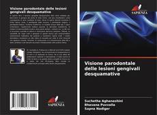 Buchcover von Visione parodontale delle lesioni gengivali desquamative