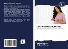 Bookcover of Гестационный диабет