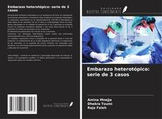 Bookcover of Embarazo heterotópico: serie de 3 casos