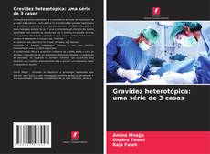 Buchcover von Gravidez heterotópica: uma série de 3 casos