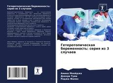 Bookcover of Гетеротопическая беременность: серия из 3 случаев