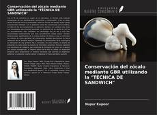 Bookcover of Conservación del zócalo mediante GBR utilizando la "TÉCNICA DE SANDWICH"