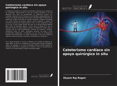 Bookcover of Cateterismo cardíaco sin apoyo quirúrgico in situ