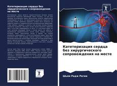 Buchcover von Катетеризация сердца без хирургического сопровождения на месте