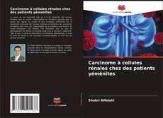 Capa do livro de Carcinome à cellules rénales chez des patients yéménites 