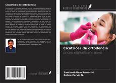 Bookcover of Cicatrices de ortodoncia