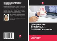 Buchcover von Cefalometria no diagnóstico e planeamento do tratamento ortodôntico