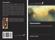 Copertina di Hipospadias