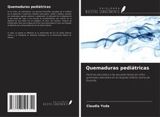 Buchcover von Quemaduras pediátricas