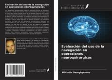Bookcover of Evaluación del uso de la navegación en operaciones neuroquirúrgicas