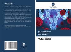 Capa do livro de Vulvakrebs 