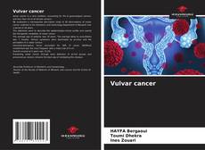 Vulvar cancer kitap kapağı