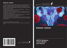 Bookcover of Cáncer vulvar