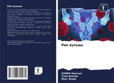 Buchcover von Рак вульвы
