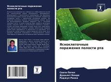 Buchcover von Ясноклеточные поражения полости рта