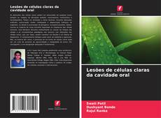 Buchcover von Lesões de células claras da cavidade oral