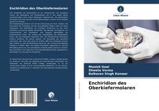 Bookcover of Enchiridion des Oberkiefermolaren