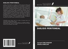 Buchcover von DIÁLISIS PERITONEAL