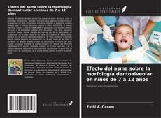 Buchcover von Efecto del asma sobre la morfología dentoalveolar en niños de 7 a 12 años