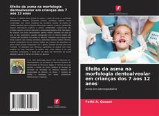 Bookcover of Efeito da asma na morfologia dentoalveolar em crianças dos 7 aos 12 anos