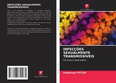 Buchcover von INFECÇÕES SEXUALMENTE TRANSMISSÍVEIS