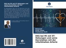 Bookcover of EKG bei MI mit ST-Hebungen und seine Korrelation mit der infarktnahen Arterie