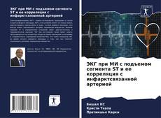 Borítókép a  ЭКГ при МИ с подъемом сегмента ST и ее корреляция с инфарктсвязанной артерией - hoz