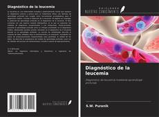 Bookcover of Diagnóstico de la leucemia