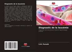 Capa do livro de Diagnostic de la leucémie 
