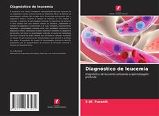 Bookcover of Diagnóstico de leucemia