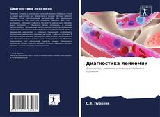 Capa do livro de Диагностика лейкемии 