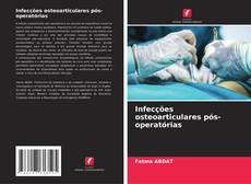 Bookcover of Infecções osteoarticulares pós-operatórias