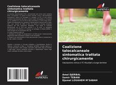 Bookcover of Coalizione talocalcaneale sintomatica trattata chirurgicamente