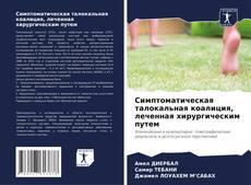 Buchcover von Симптоматическая талокальная коалиция, леченная хирургическим путем