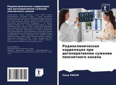 Bookcover of Радиоклиническая корреляция при дегенеративном сужении поясничного канала