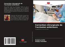Buchcover von Correction chirurgicale de l'occlusion antérieure