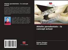Buchcover von Attelle parodontale : le concept actuel