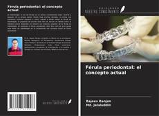 Bookcover of Férula periodontal: el concepto actual