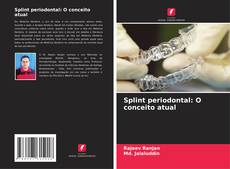 Bookcover of Splint periodontal: O conceito atual