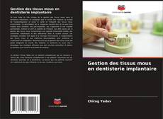 Couverture de Gestion des tissus mous en dentisterie implantaire