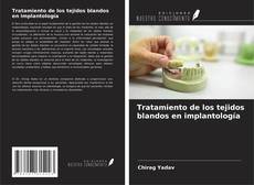 Capa do livro de Tratamiento de los tejidos blandos en implantología 