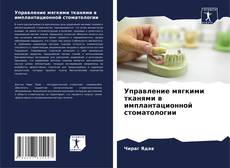 Buchcover von Управление мягкими тканями в имплантационной стоматологии