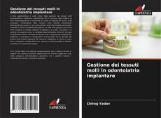 Bookcover of Gestione dei tessuti molli in odontoiatria implantare