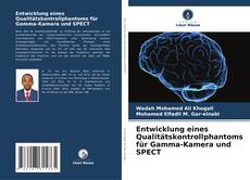 Bookcover of Entwicklung eines Qualitätskontrollphantoms für Gamma-Kamera und SPECT