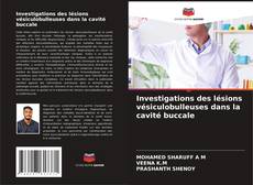 Buchcover von Investigations des lésions vésiculobulleuses dans la cavité buccale