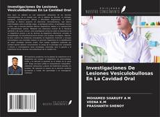 Investigaciones De Lesiones Vesiculobullosas En La Cavidad Oral的封面