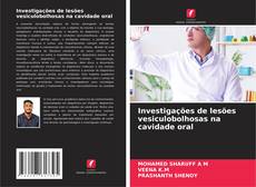 Buchcover von Investigações de lesões vesiculobolhosas na cavidade oral