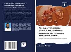 Couverture de Как вырастить мочевой камень и подагрические кристаллы на стеклянном предметном стекле